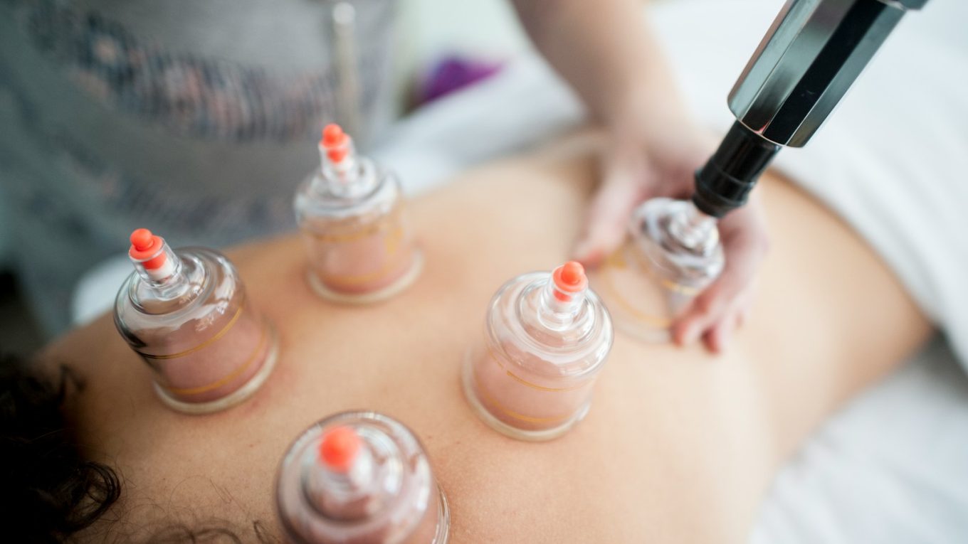 cupping Amsterdam