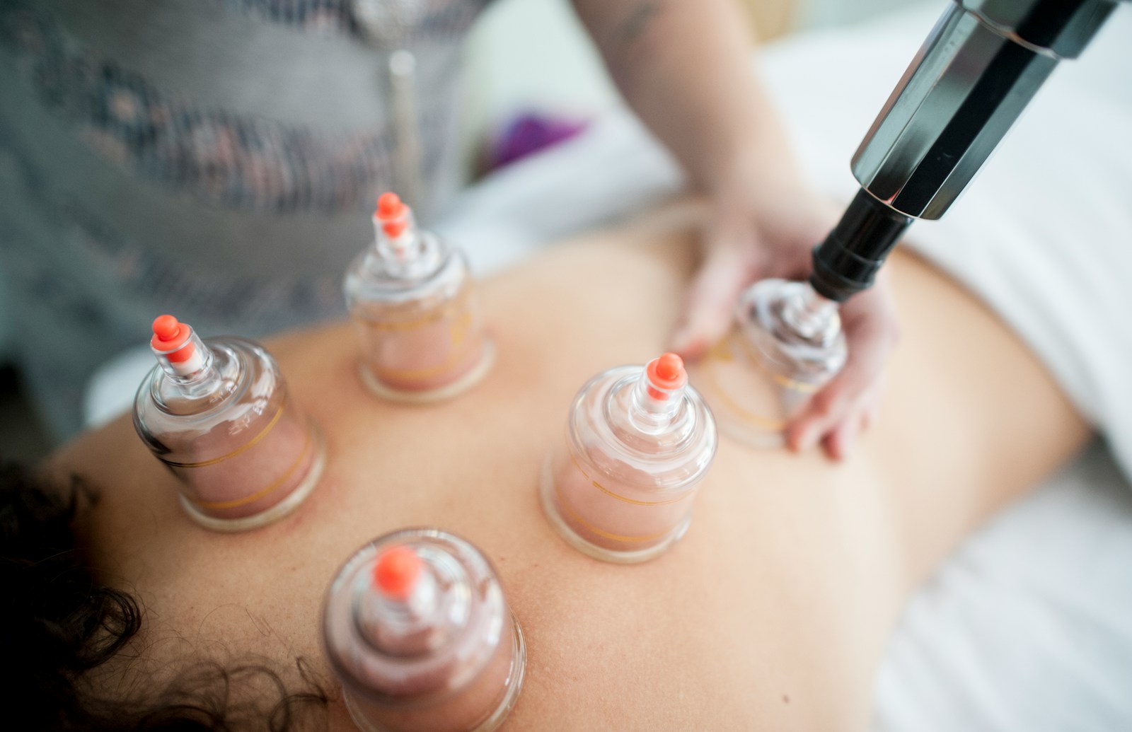 cupping Amsterdam